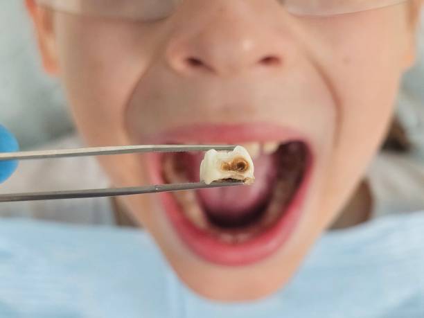 Best Emergency Pediatric Dentist  in Mckinney, TX